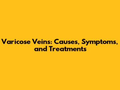 Varicose Veins: Causes, Symptoms, and Treatments